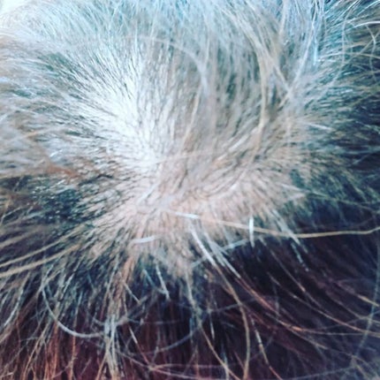 アホ毛フィクサー/アイケイ/ヘアバームを使ったクチコミ(4枚目)