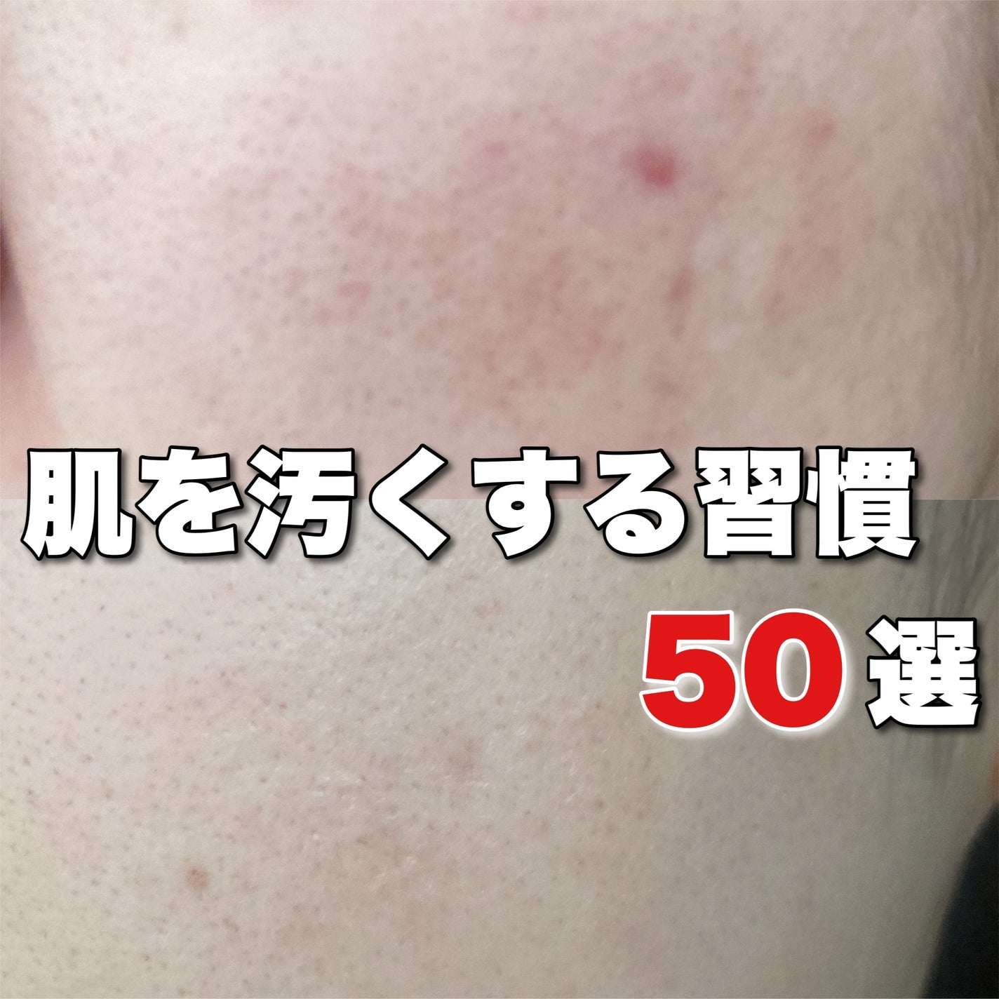 潤浸保湿 化粧水 III とてもしっとり/キュレル/化粧水を使ったクチコミ(1枚目)