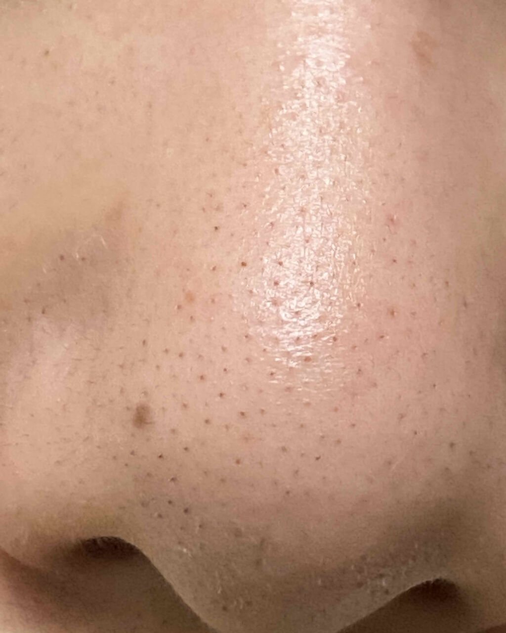 ハトムギ化粧水(ナチュリエ スキンコンディショナー R )/ナチュリエ/化粧水を使ったクチコミ（3枚目）