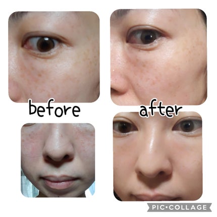 ビモラコスメ VC/BimoRa/美容液を使ったクチコミ(2枚目)