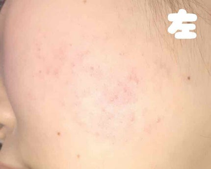 ハトムギ化粧水(ナチュリエ スキンコンディショナー R )/ナチュリエ/化粧水を使ったクチコミ(2枚目)