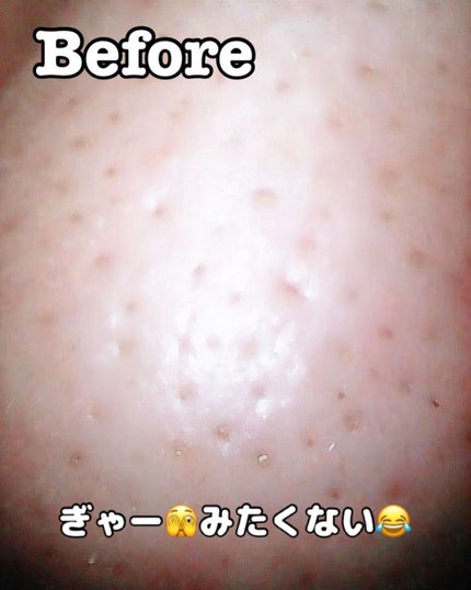 ゼロ毛穴パッド 2.0/MEDICUBE/トナーパッドを使ったクチコミ(6枚目)