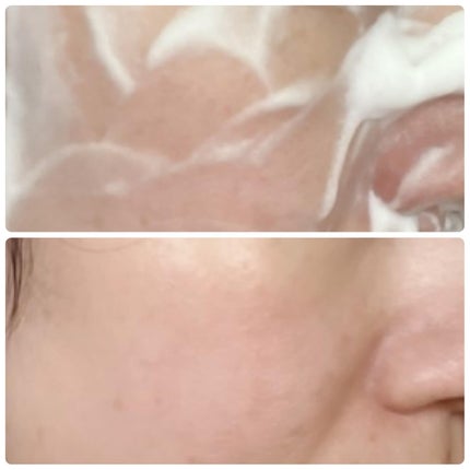 スイスキン 新芽ディープクレンジングフォーム/suiskin/洗顔フォームを使ったクチコミ(4枚目)