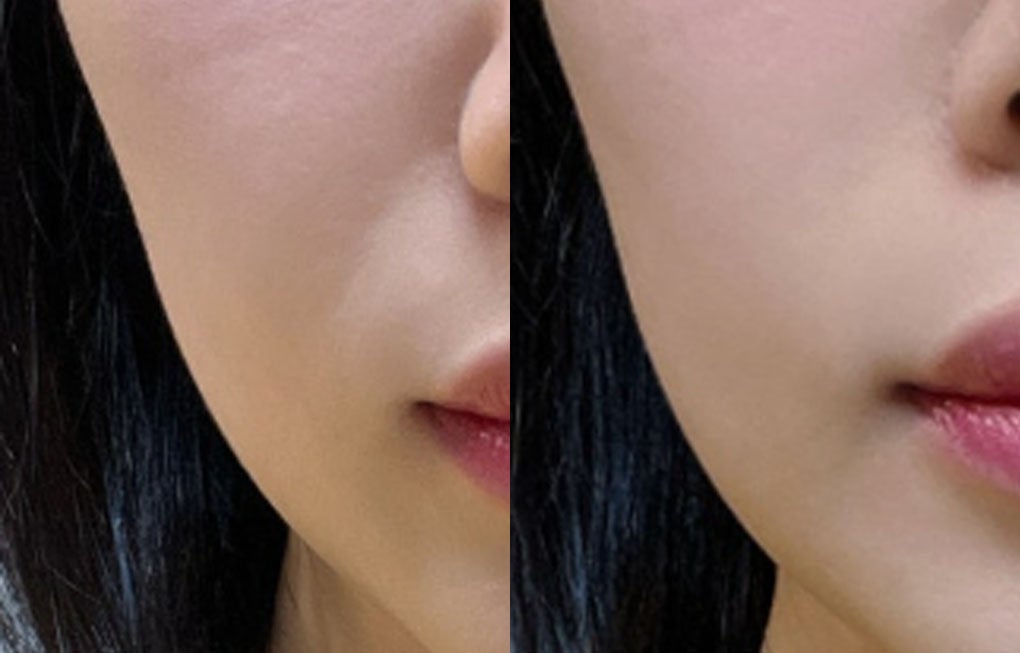 ボツルショット700/CELLINSHOT/ブースター・導入液を使ったクチコミ(1枚目)