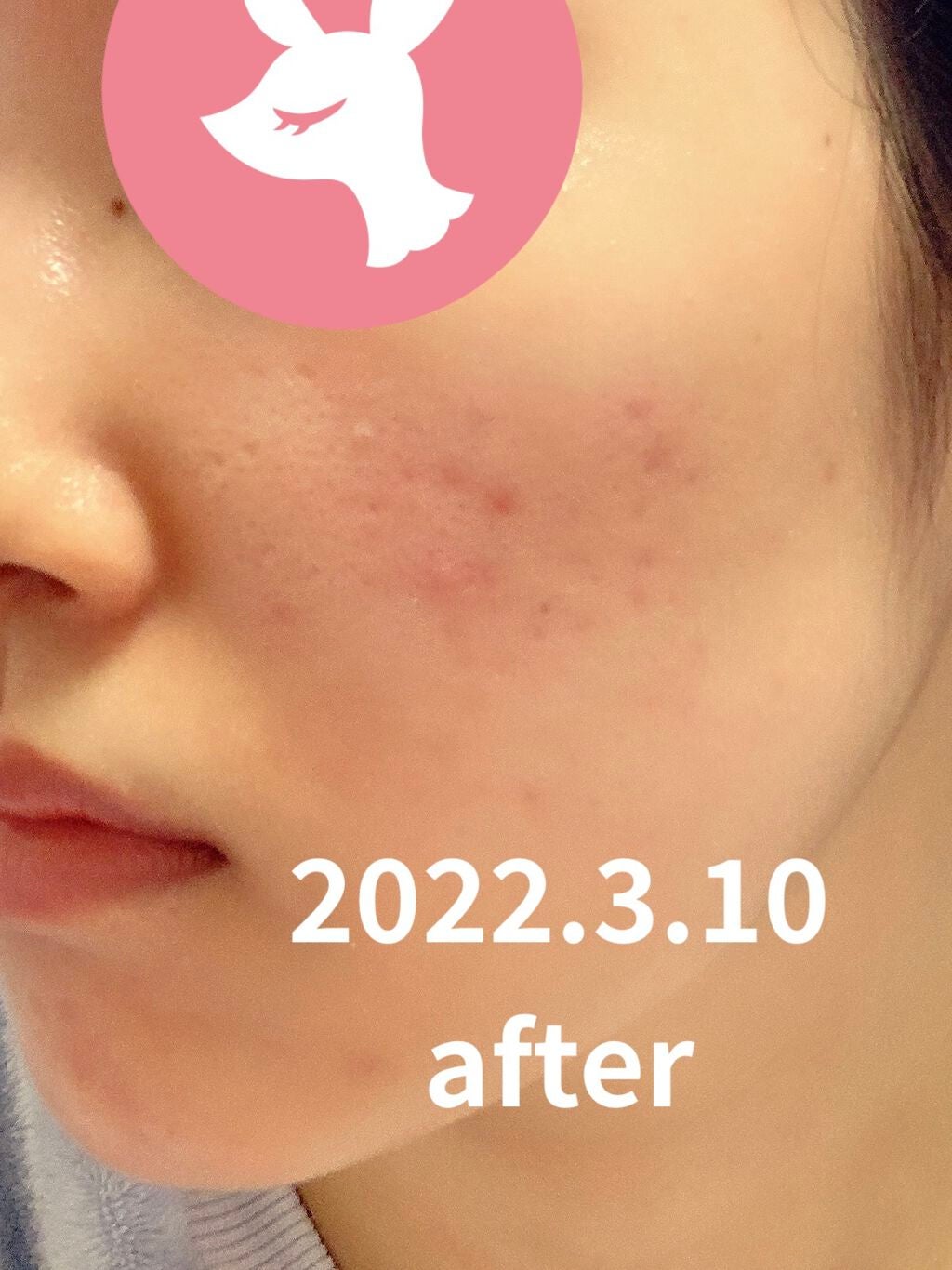 Noni Ampule/celimax/美容液を使ったクチコミ(2枚目)