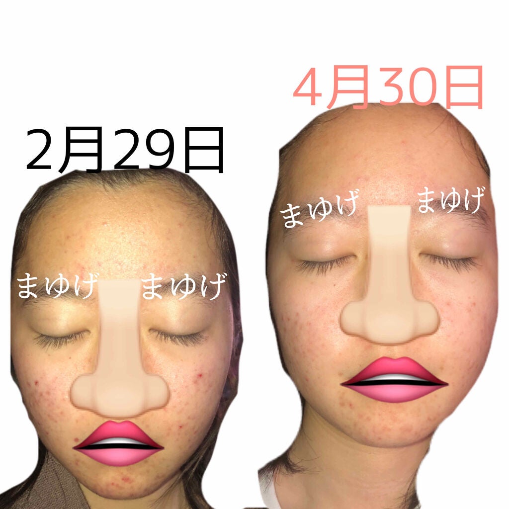 潤浸保湿 フェイスクリーム/キュレル/フェイスクリームを使ったクチコミ(2枚目)