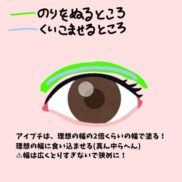 私の夜の二重癖付け方法

今日は私の夜の癖付け方法教えます！
使うのはアイトークです。

まず、普通にアイプチしてください！
私は、理想より狭めになるような幅にしています。
ポイントは結構たっぷりめに塗ること！
塗って乾かしたら、だいたい真ん中らへんにプッシャーで食い込ませます。そうすると、上下にくっつくので取れにくいし、ひゅん現象が起こりにくくなります！
そしたら寝ます！😴
朝起きたら水でアイプチを取ってください！

皆さん、朝にアイプチすぐ取れなくて擦っちゃうなんてことありませんか？
これは絶対良くないです！まぶたが伸びますし、荒れます。
そこで私は対策を考えました！
それは.....

まぶたに乳液を塗ってからアイプチをする！！

です！

えっ？ってなりますよね。
油分をとらないと、アイプチがとれるんじゃないの？いや違うんです！！！
私のまぶたは、とれやすいとレビューに書いてあったアイトークでもかなり擦らないととれないんです。なので、まぶたに負担がかかります。
でも、乳液を塗ったら水だけですぐに取れます！！
乳液もなるべく多めに塗ることと、塗ったらすぐにアイプチをすることが大事です！！
ぜひお試しください✨の画像 その0