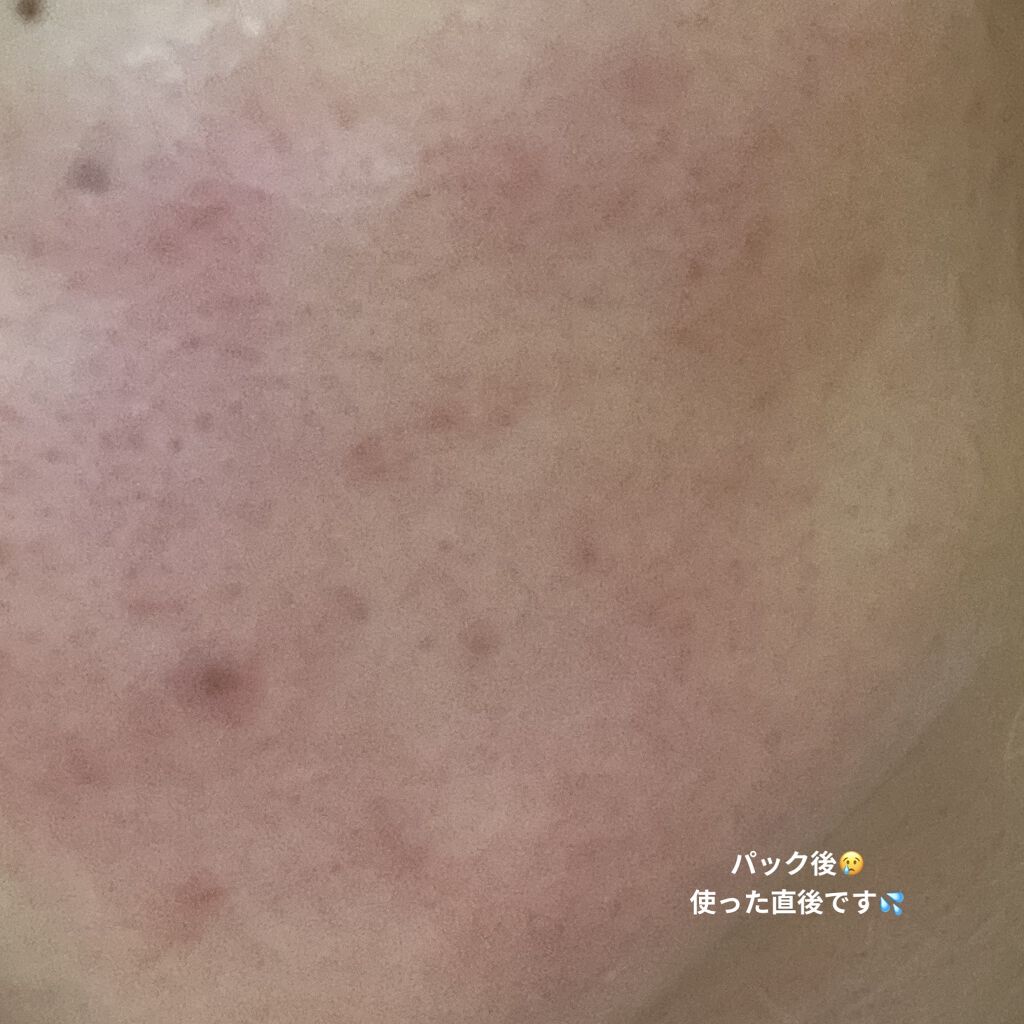 ボタニカルオールインワンフェイスマスク/ボタニカル/シートマスク・パックを使ったクチコミ（2枚目）