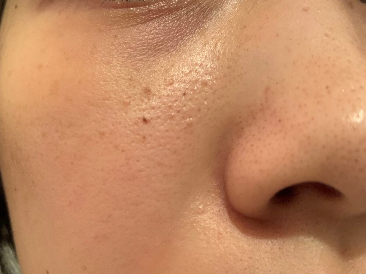 C10 ã°ã㊠ã»ã©ã /THE BODY SHOP/çŸå®¹æ¶²ã䜿ã£ãã¯ãã³ãïŒ5æç®ïŒ