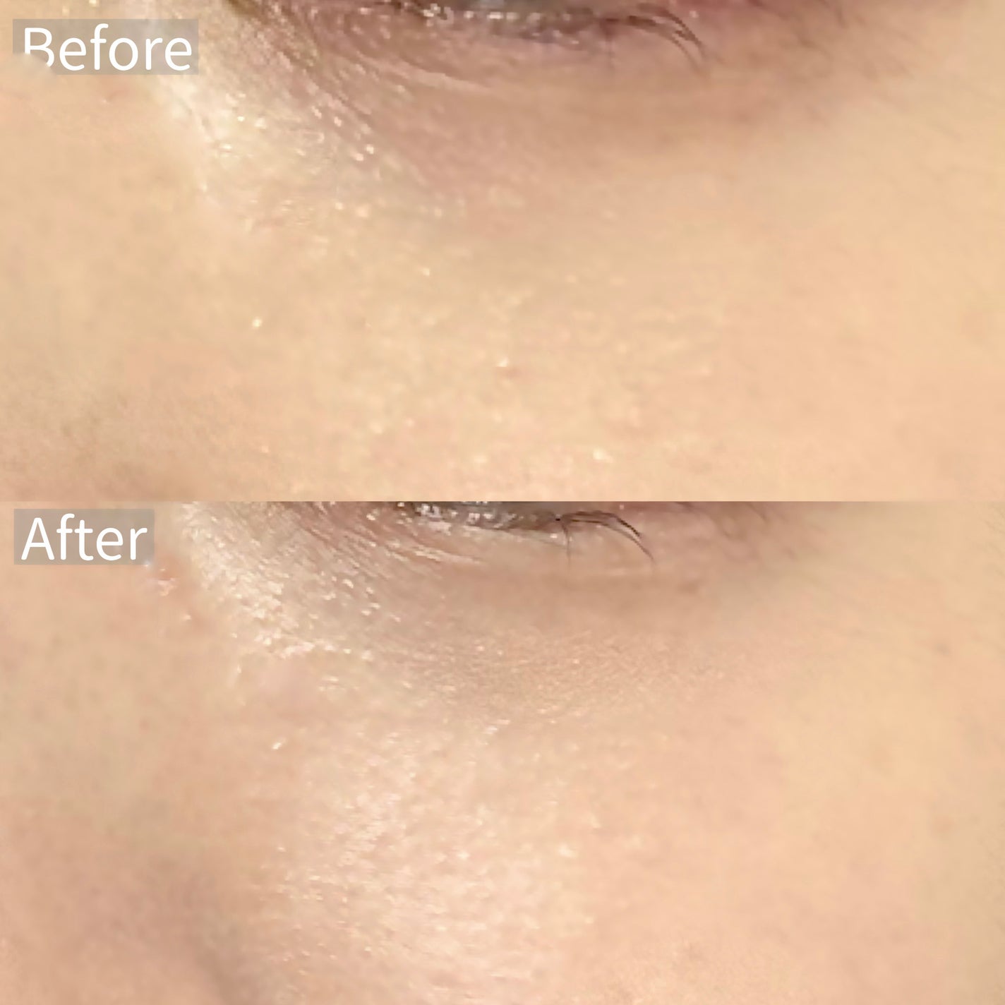 カバーアッププロコンシーラー/TFIT/パレットコンシーラーを使ったクチコミ(5枚目)