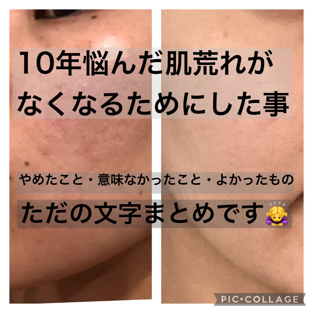 ジョンソン ベビーオイル 無香料/ジョンソンベビー/ボディオイルを使ったクチコミ（1枚目）