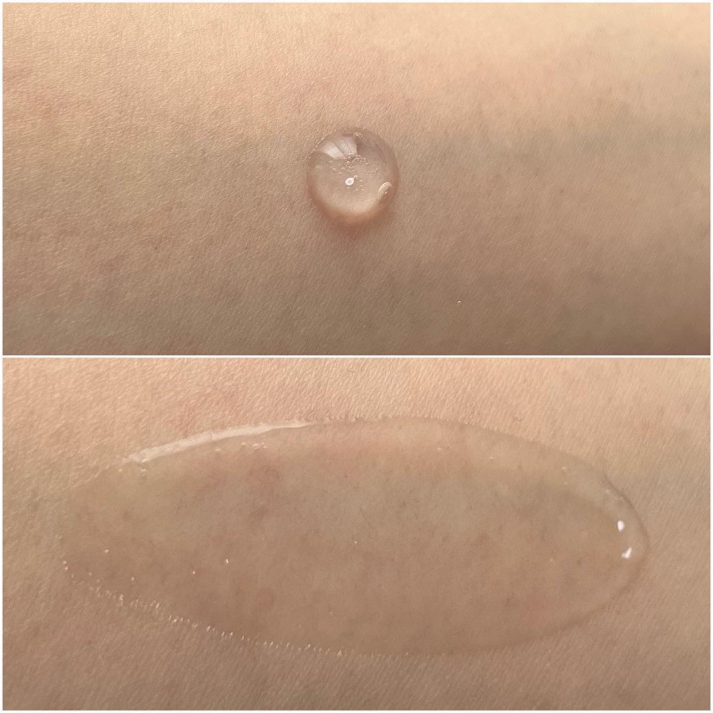 ピンクティーツリーシナジーセラム/APLIN/美容液を使ったクチコミ(10枚目)