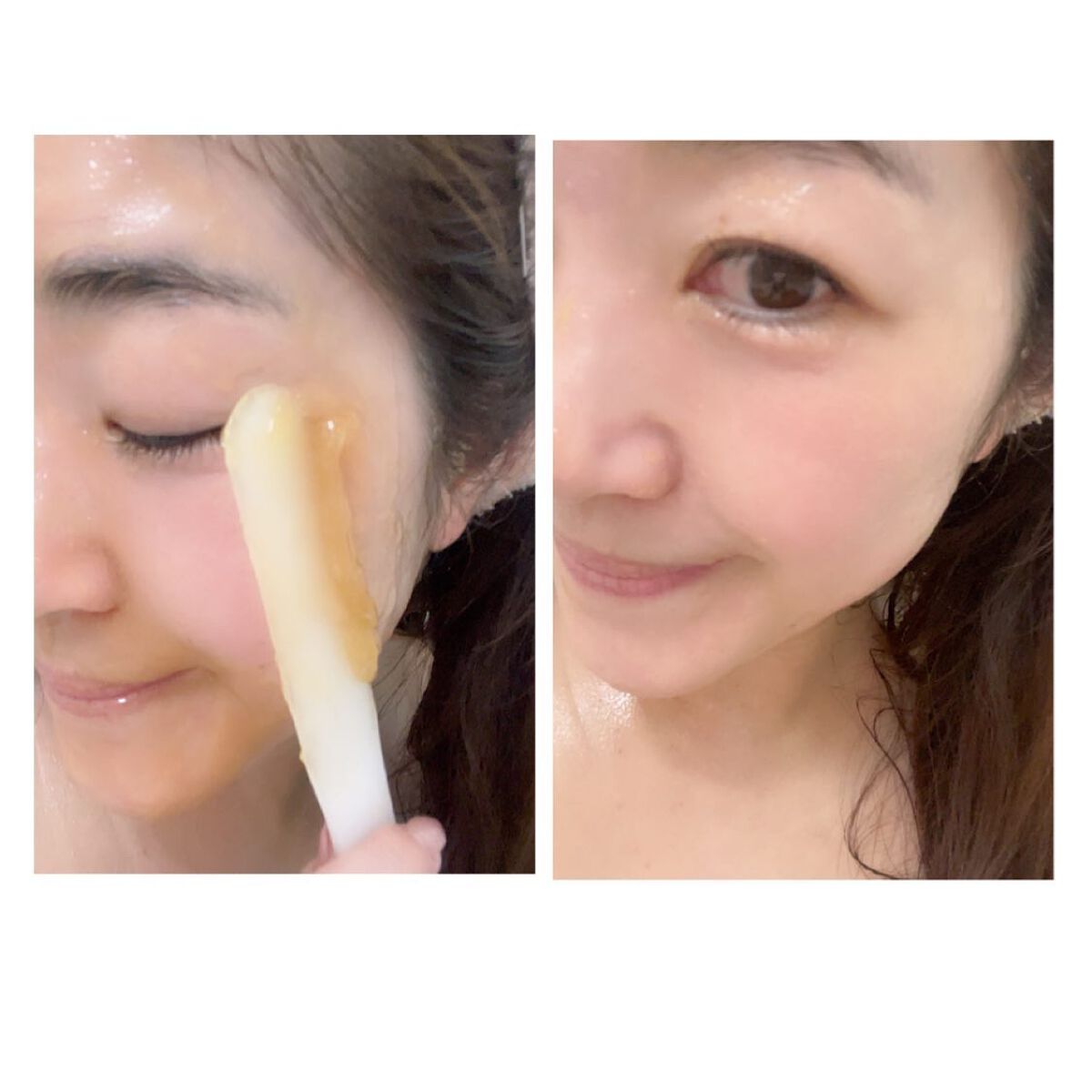 メディプローラー CO2ジェルマスク/ドクターメディオン/洗い流すパック・マスクを使ったクチコミ(8枚目)