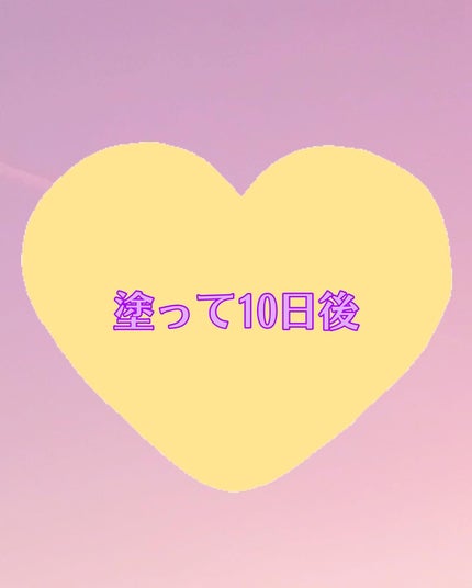 EMAKED(エマーキット)/水橋保寿堂製薬/まつげ美容液を使ったクチコミ(6枚目)