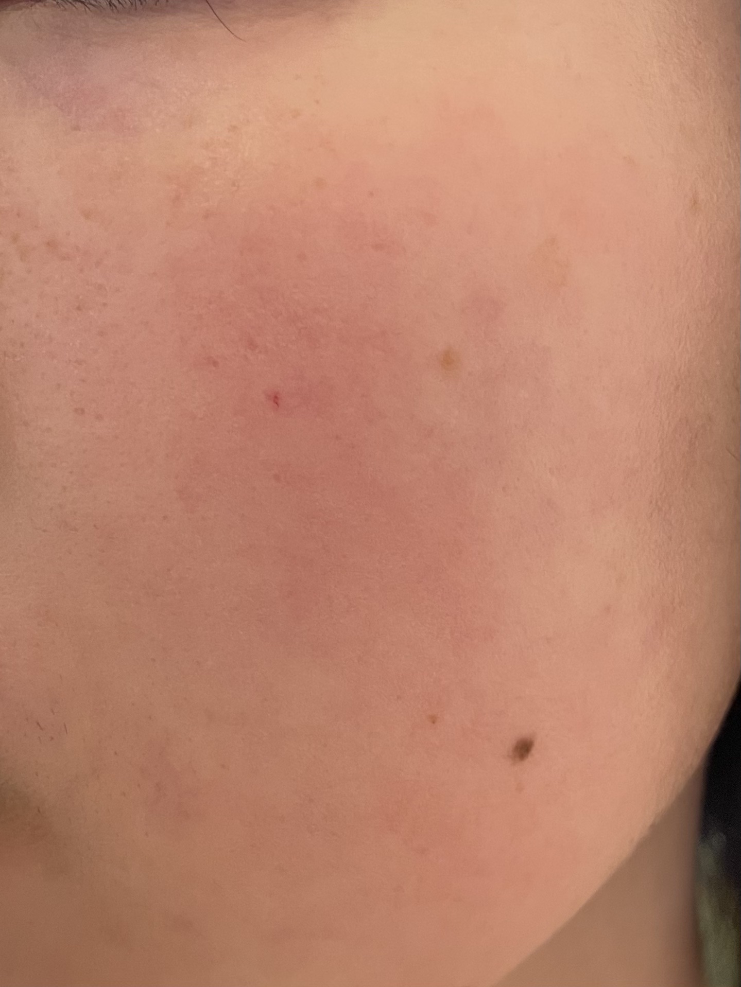 瞬間クッションファンデーション/CHARDE/クッションファンデーションを使ったクチコミ（2枚目）