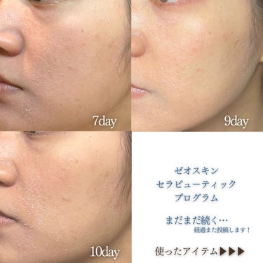BSサンスクリーンSPF50/ZO Skin Health/日焼け止め・UVケアを使ったクチコミ（3枚目）