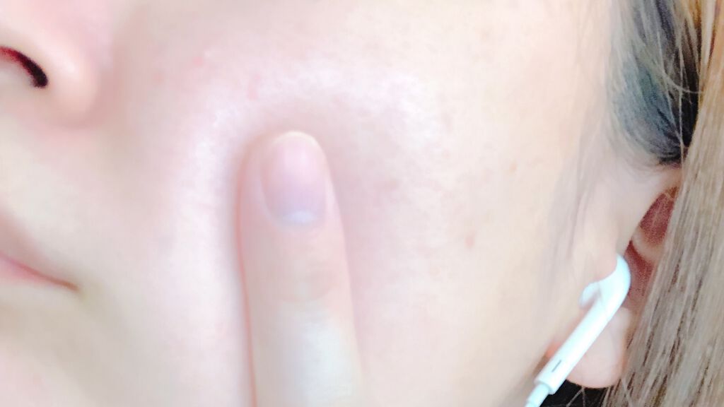 スーパー毛穴ピールセラム/ラボラボ/美容液を使ったクチコミ（3枚目）