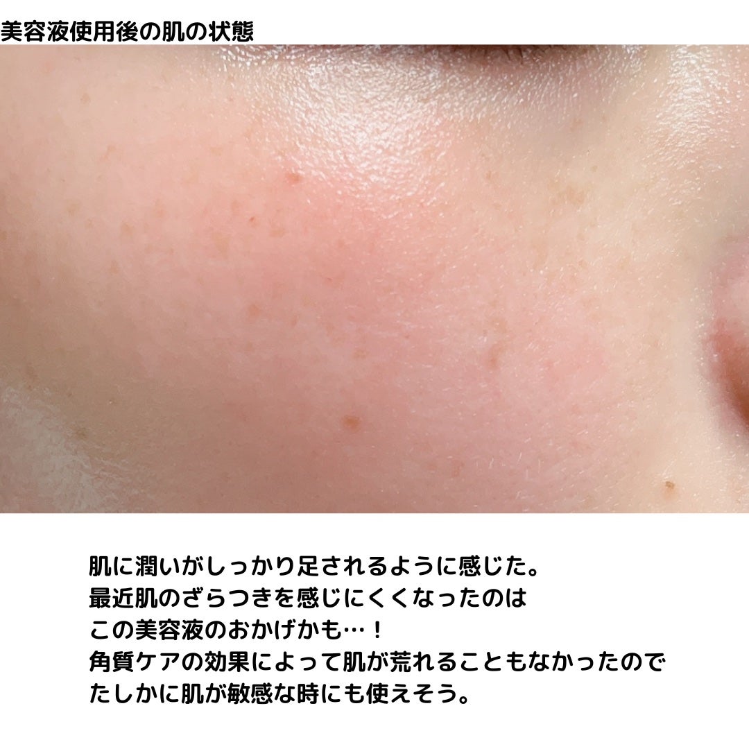エファクラ ピールケア セラム/ラ ロッシュ ポゼ/美容液を使ったクチコミ(7枚目)