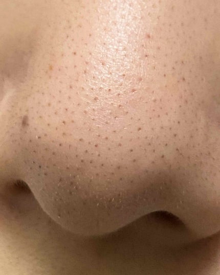 ハトムギ化粧水(ナチュリエ スキンコンディショナー R )/ナチュリエ/化粧水を使ったクチコミ(3枚目)