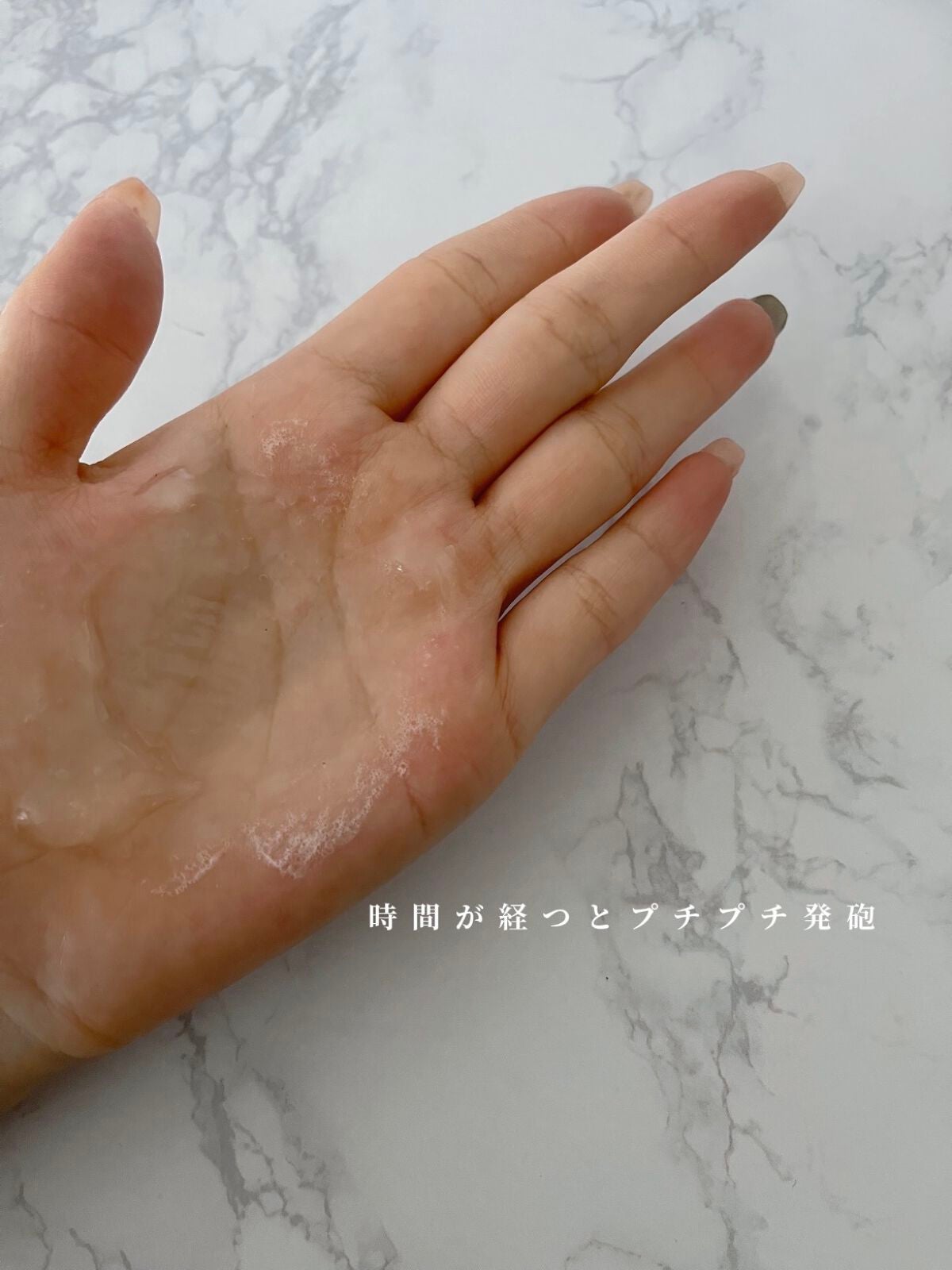 スパークロイドパック/MICHIKO.LIFE/洗い流すパック・マスクを使ったクチコミ(6枚目)