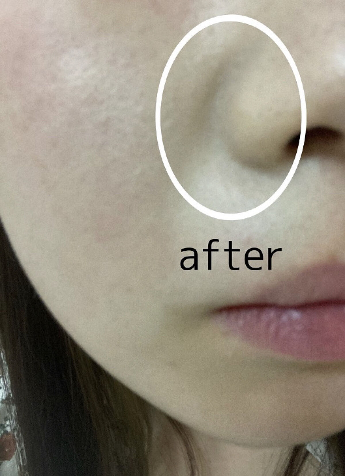 カバーパーフェクション チップコンシーラー グリーンベージュ/the SAEM/リキッドコンシーラーを使ったクチコミ（3枚目）