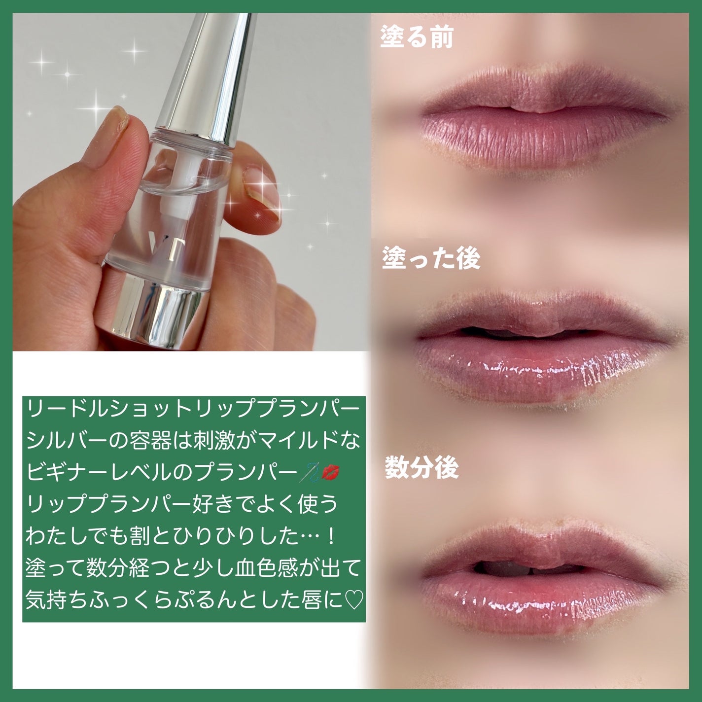 リードルS リッププランパービギナー/VT/リッププランパーを使ったクチコミ(2枚目)