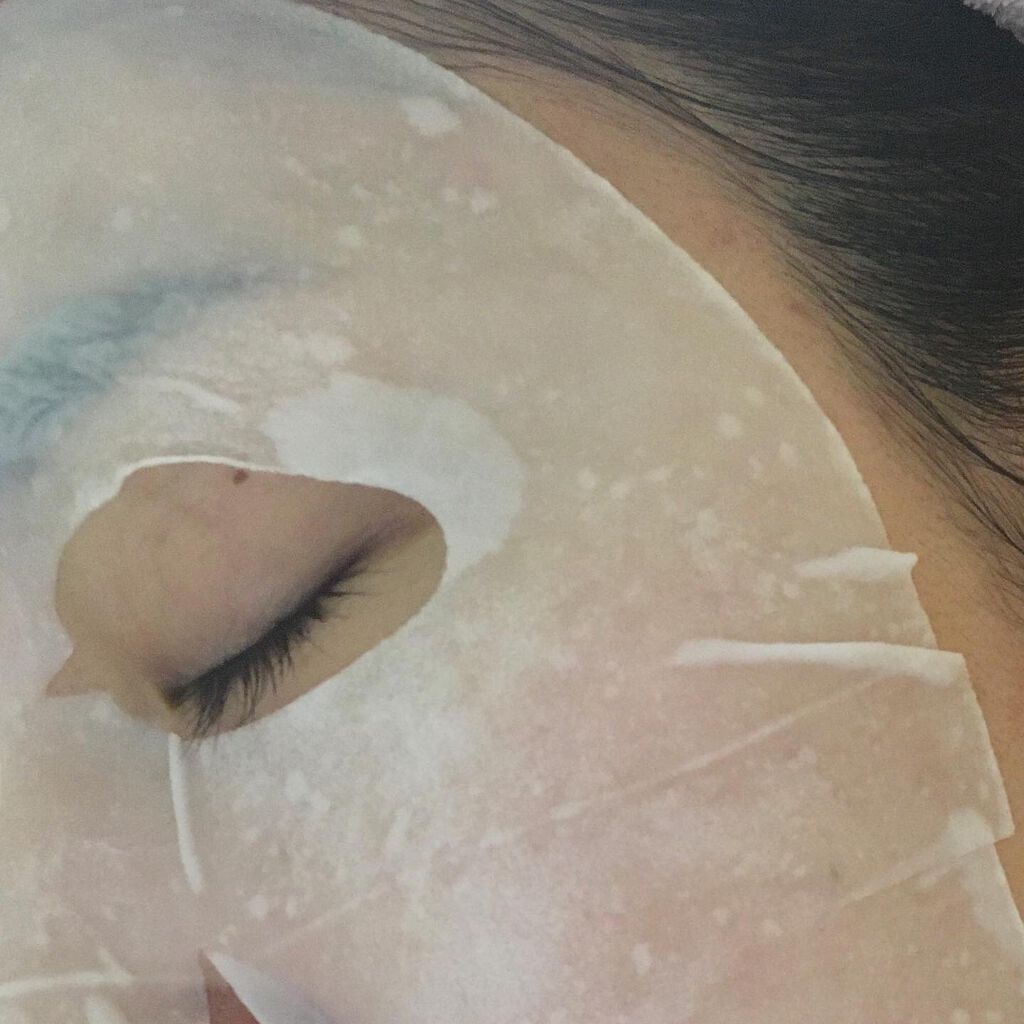 D:NA プロアチンマスク/MEDIHEAL/シートマスク・パックを使ったクチコミ(4枚目)