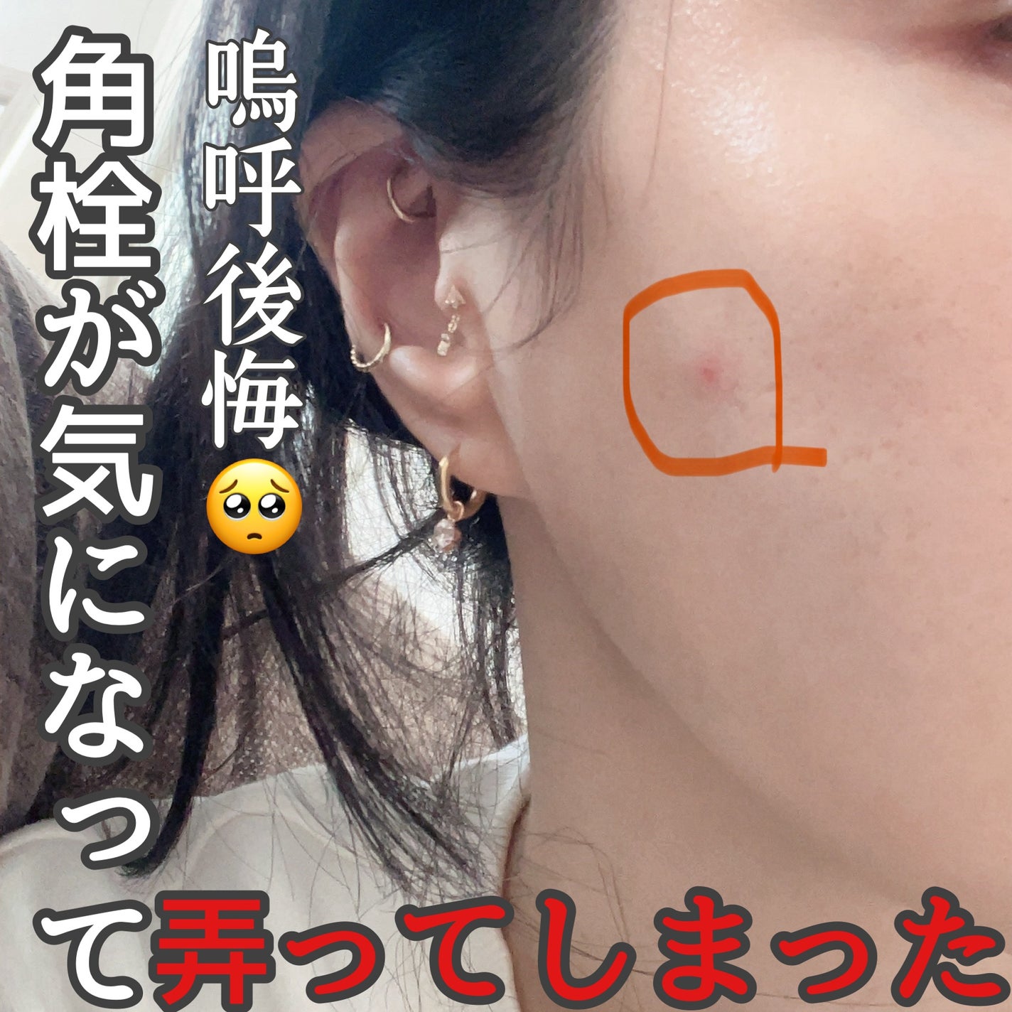 RXザ・ビタミンC23セラム/COSRX/美容液を使ったクチコミ(1枚目)