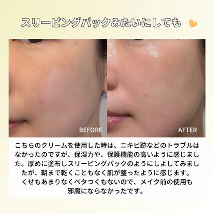 レッドブレミッシュ リペアスージングクリーム/Dr.G/フェイスクリームを使ったクチコミ(4枚目)