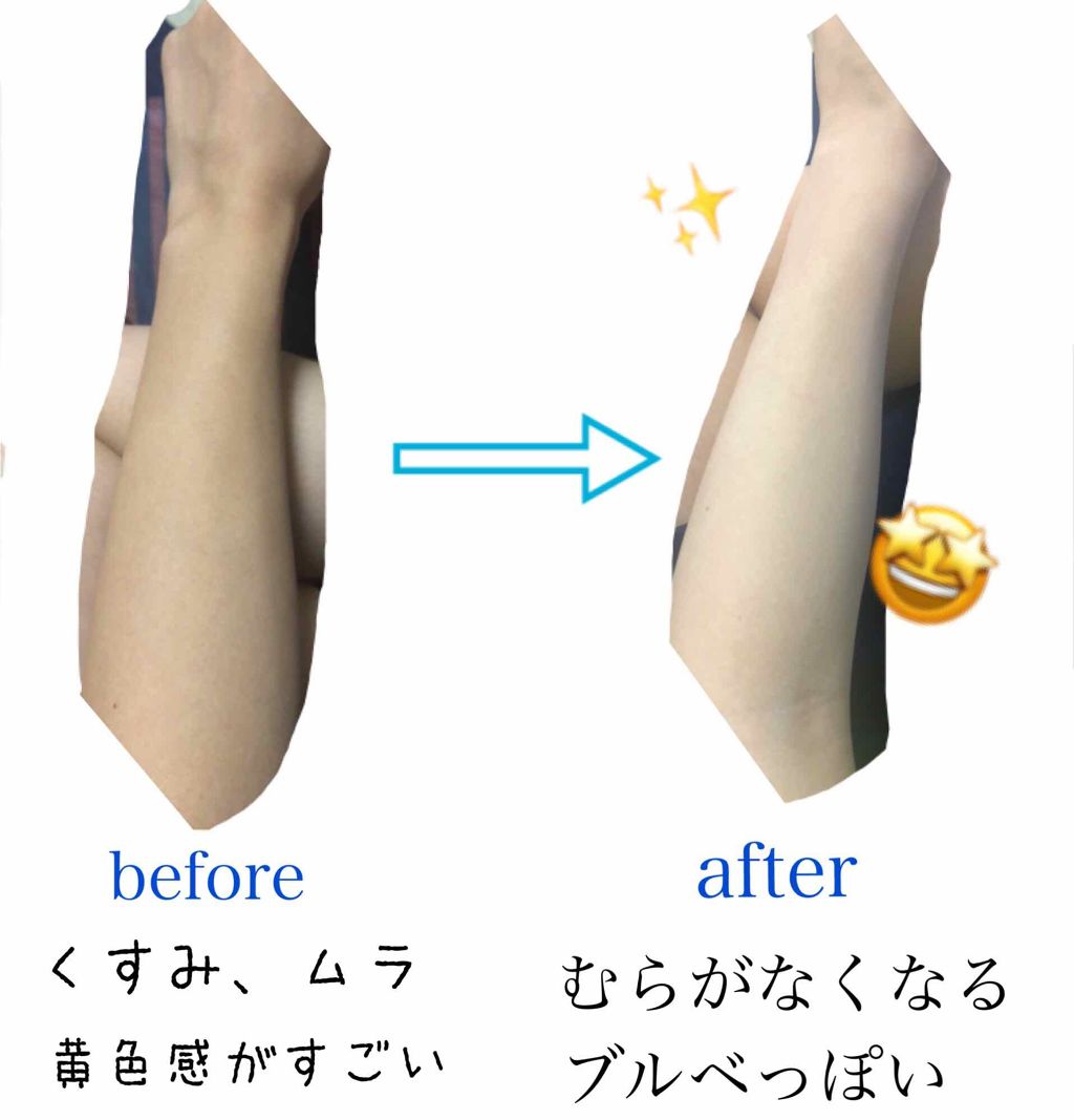 シークレットソルーションウェディングドレスピュアクリーム/It's skin/フェイスクリームを使ったクチコミ(2枚目)