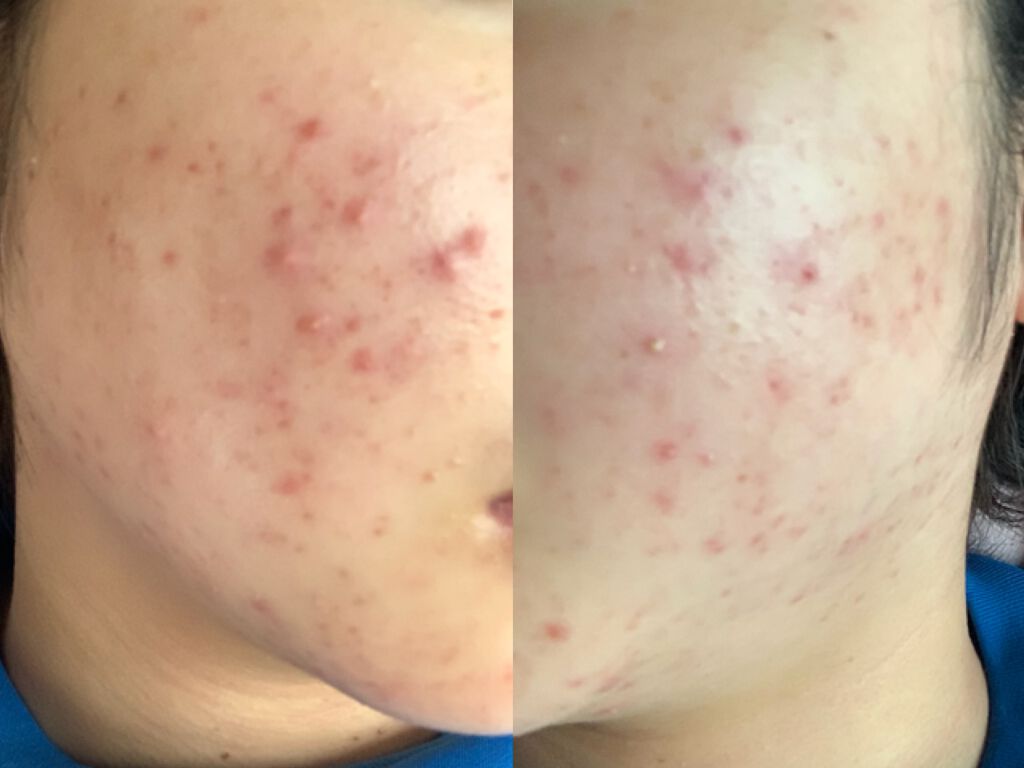 GALACTOMY CLEARSKIN TONER/manyo/化粧水を使ったクチコミ（1枚目）