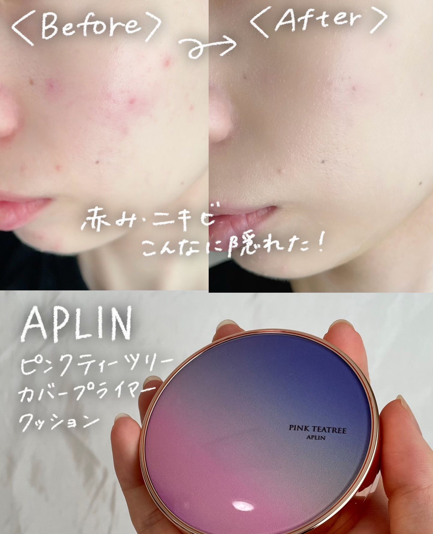 ピンクティーツリーカバープライマークッション/APLIN/クッションファンデーションを使ったクチコミ（1枚目）