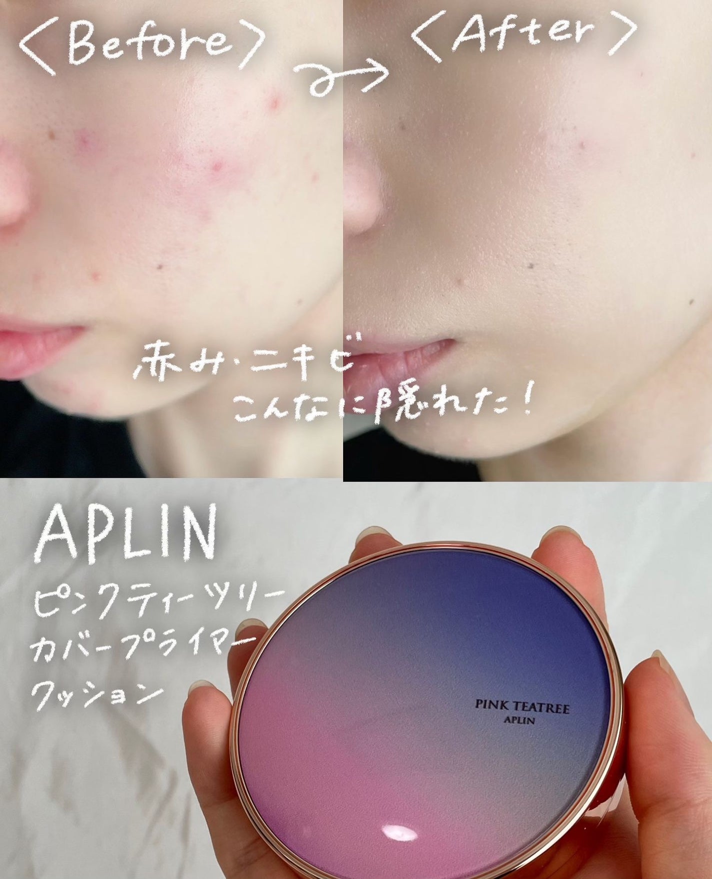 ピンクティーツリーカバープライマークッション/APLIN/クッションファンデーションを使ったクチコミ(1枚目)