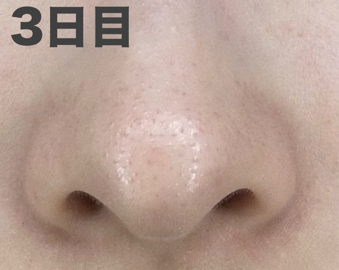 デュオ ザ ウォッシュ ブラックリペア/DUO/洗顔パウダーを使ったクチコミ(7枚目)