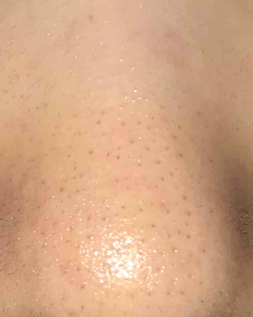 ノブ A アクネソープ/NOV/洗顔石鹸を使ったクチコミ(2枚目)