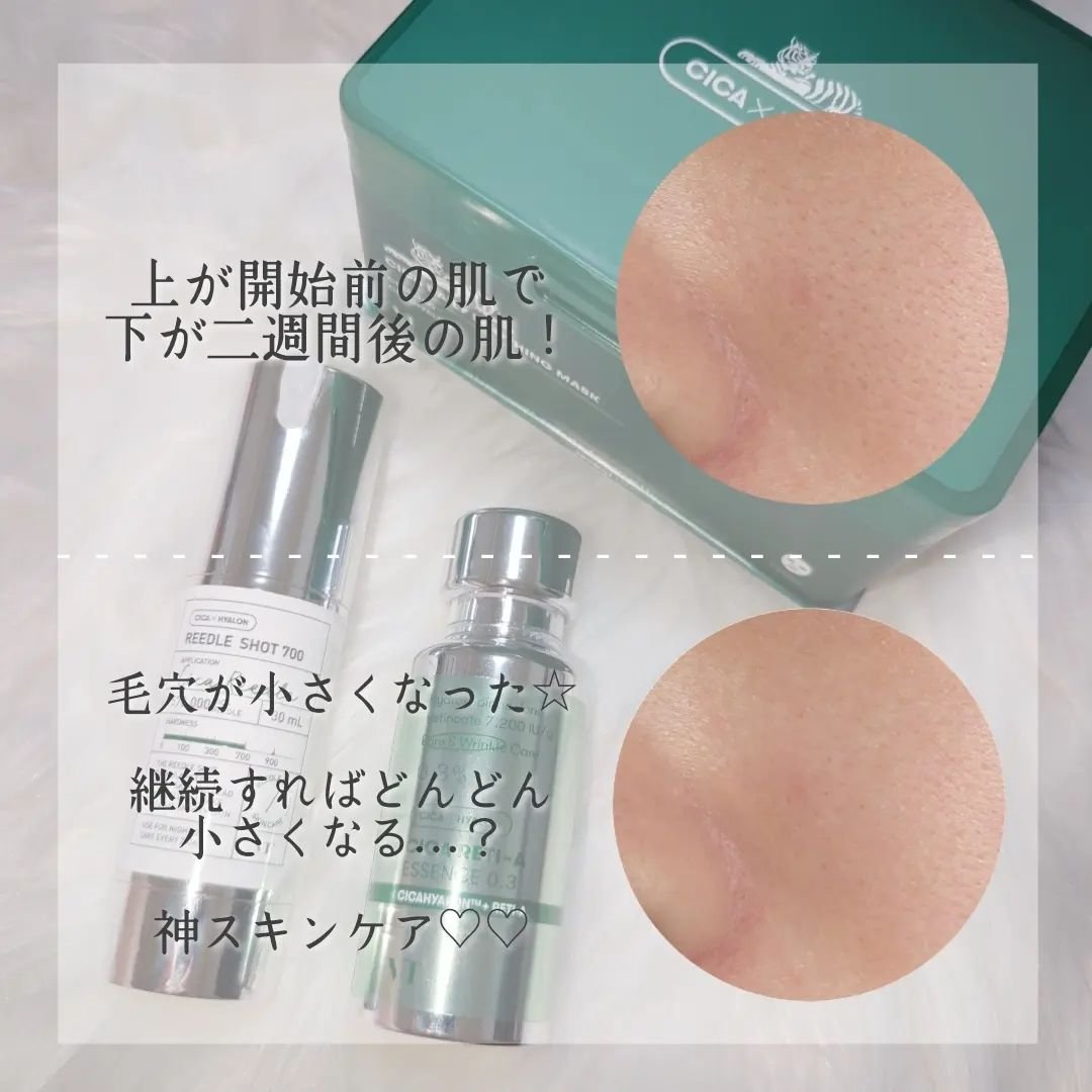 シカレチA エッセンス0.3/VT/美容液を使ったクチコミ（3枚目）