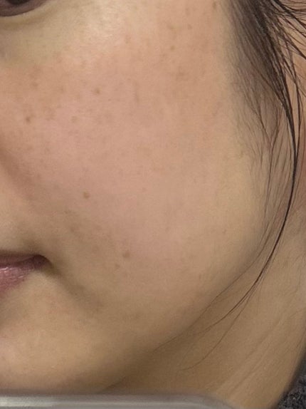 PDRNカフェインショット/IOPE/美容液を使ったクチコミ(4枚目)