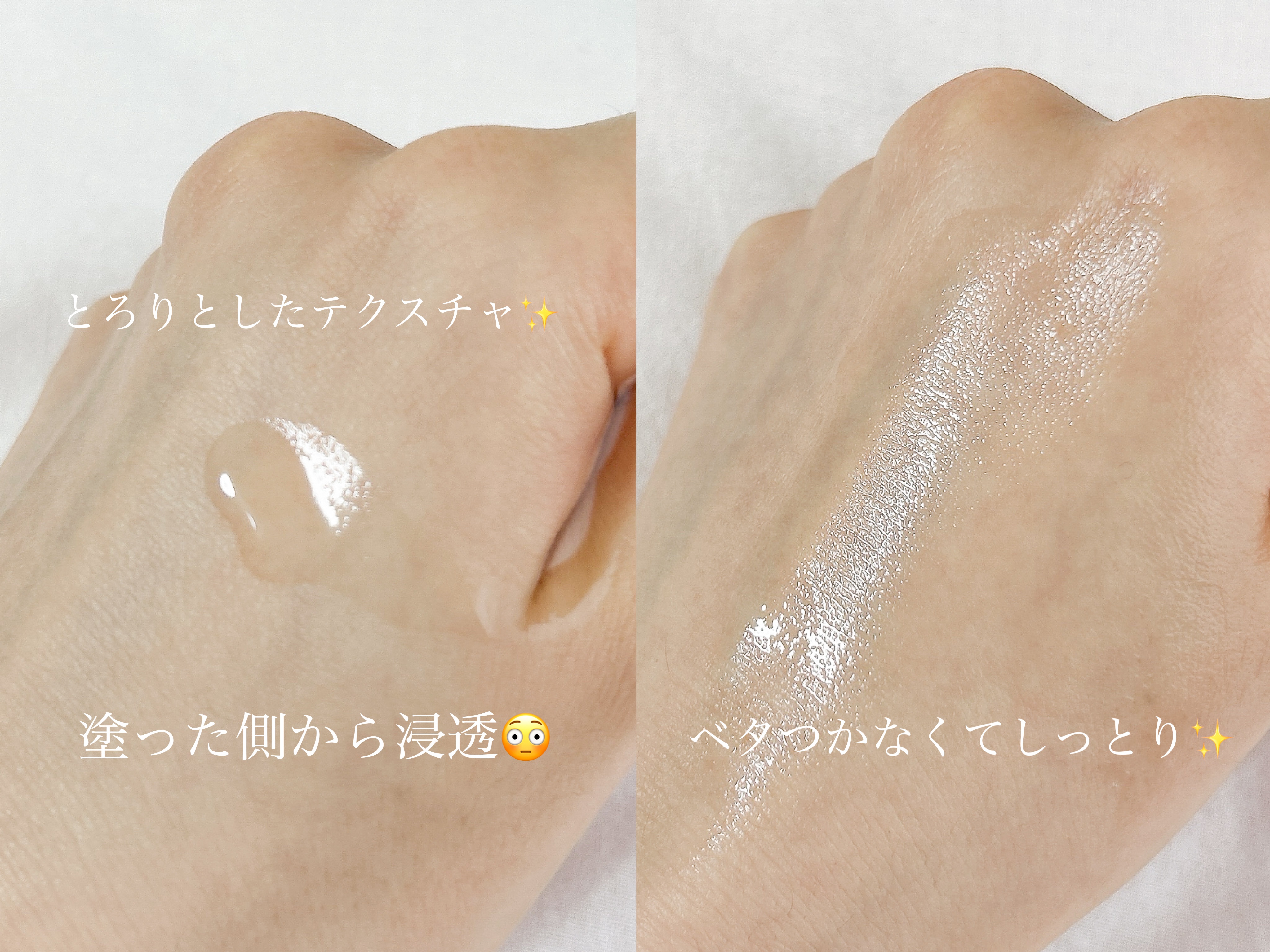 VC100エッセンスローション EX/ドクターシーラボⓇ/化粧水を使ったクチコミ（2枚目）