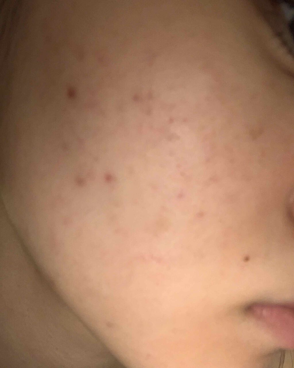 ぴ on LIPS 「6月でキュレルの化粧水を使い終わりました!なんとなく良くなって..」(3枚目)