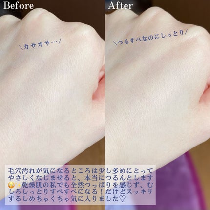 ダヴ 吸着毛穴ケア 洗顔ジェル/ダヴ/その他洗顔料を使ったクチコミ(4枚目)