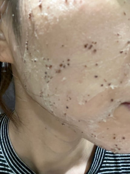 角質スッキリ毛穴パック /HANYUL(ハンユル)/洗い流すパック・マスクを使ったクチコミ(2枚目)