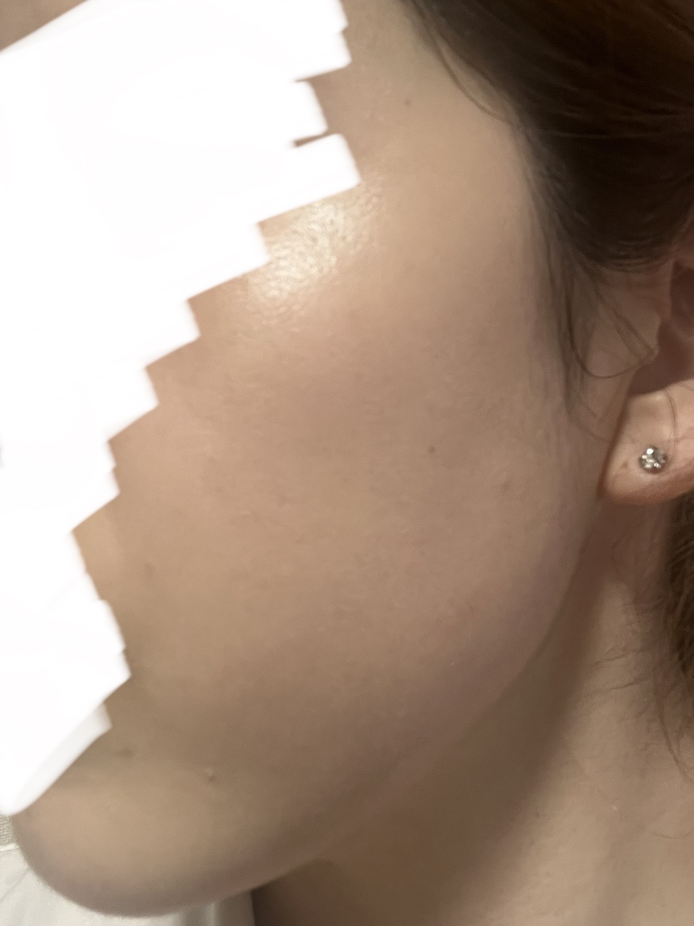 ディオールスキン フォーエヴァー スキン コレクト コンシーラー/Dior/リキッドコンシーラーを使ったクチコミ（2枚目）