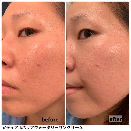 デュアルバリアウォータリーサンクリーム/celimax/日焼け止めクリームを使ったクチコミ(7枚目)