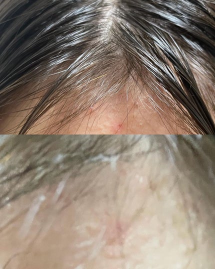 AHA·BHA·PHA 30デイズミラクルトナー/SOME BY MI/化粧水を使ったクチコミ(7枚目)