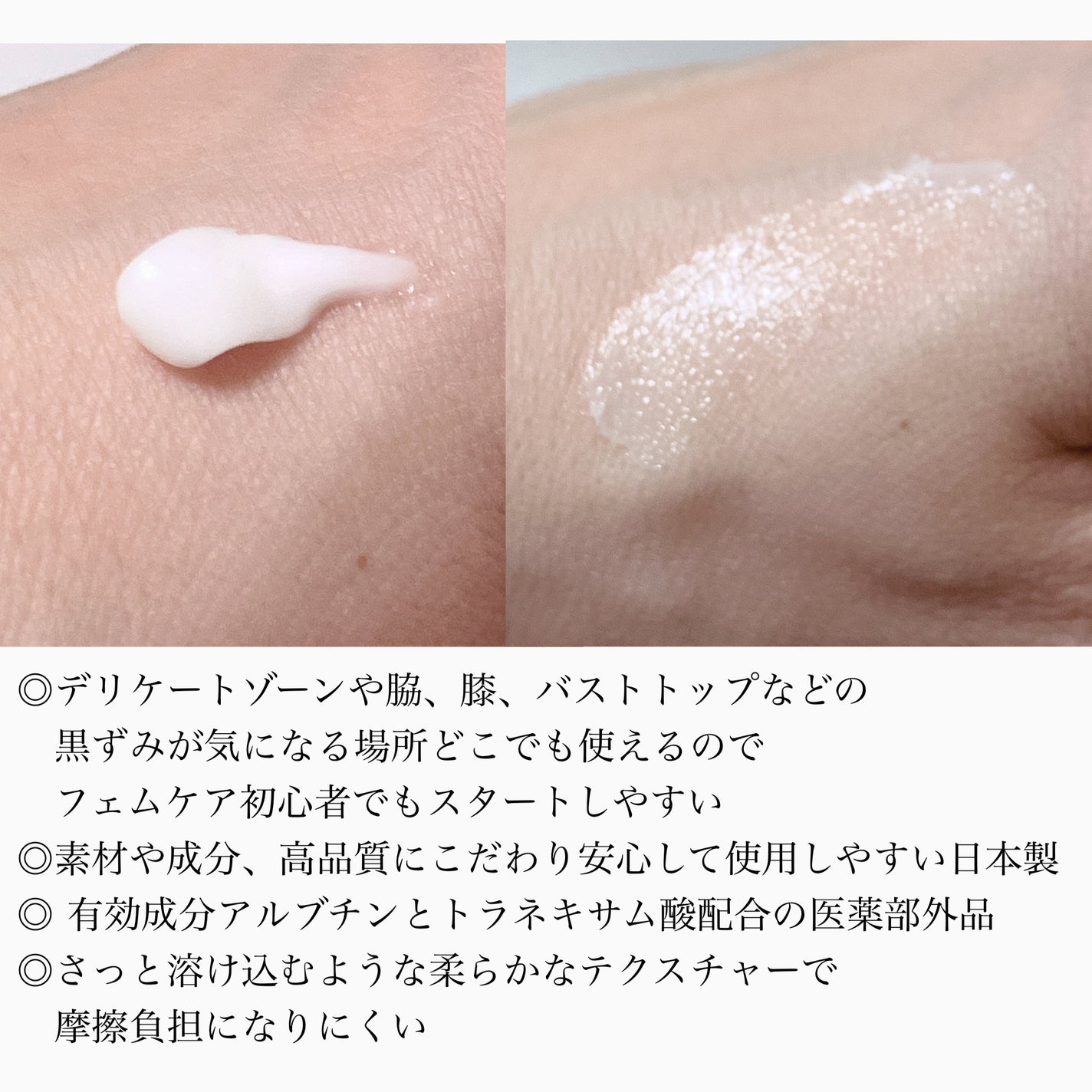 薬用ホワイトケアクリーム/DELIWHITE/デリケートゾーンケアを使ったクチコミ(2枚目)
