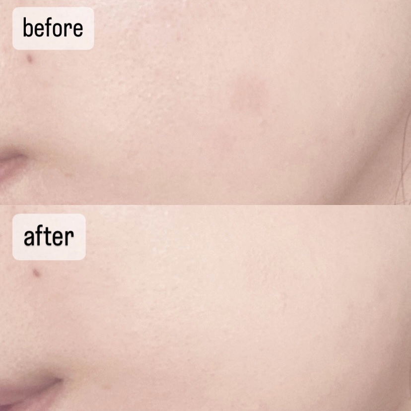 カバーアッププロコンシーラー/TFIT/パレットコンシーラーを使ったクチコミ（2枚目）