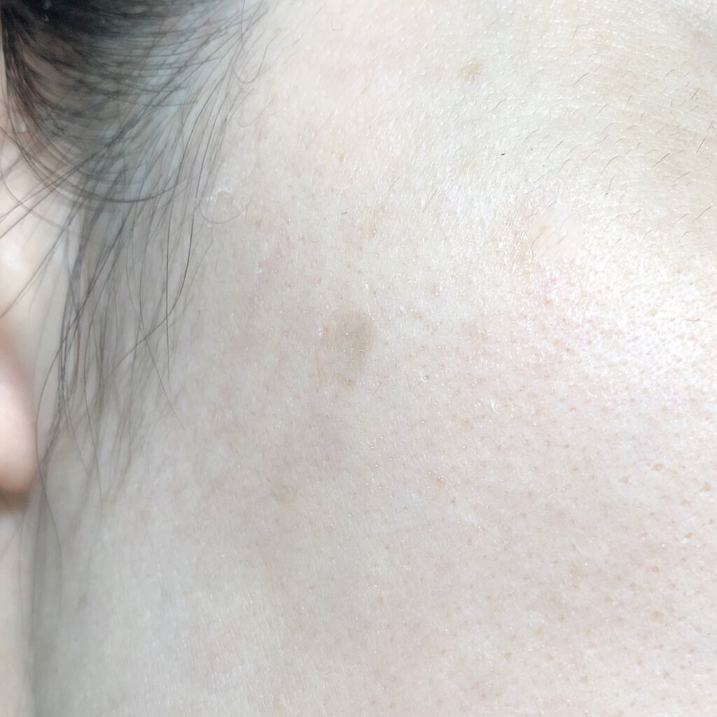 ミネラルカバー薬用美白ファンデセラム/ミリオナ化粧品/美容液を使ったクチコミ（2枚目）