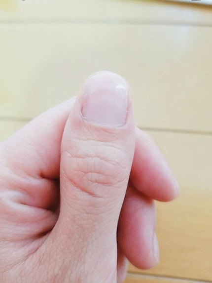 ネイルホリック ベースコート SP031 コンシーラー/ネイルホリック/ネイルベースコートを使ったクチコミ(2枚目)