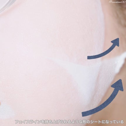 ルルルン ハイドラ V マスク/ルルルン/シートマスク・パックを使ったクチコミ(3枚目)