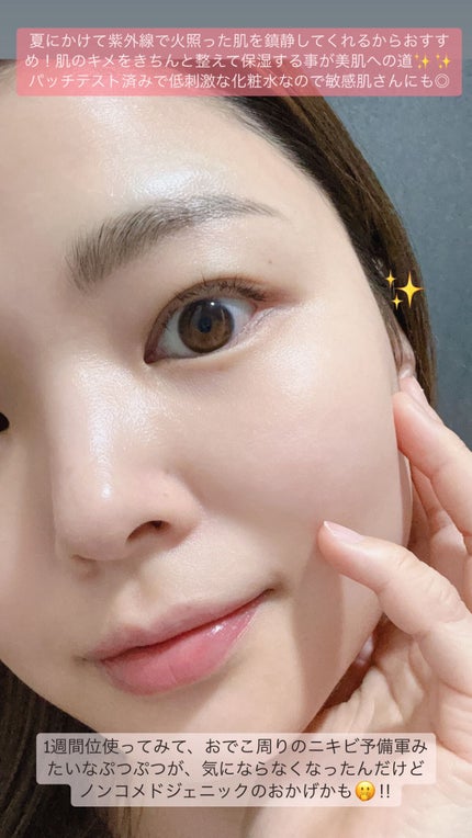 ドクダミ 77 スージングトナー/Anua/化粧水を使ったクチコミ(4枚目)